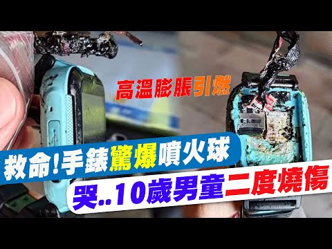 【每日必看】救命!手錶爆炸噴火球 專家:電池膨脹高溫勿用 20230704 @中天新聞CtiNews