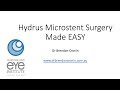 Hydrus stent surgery made easy