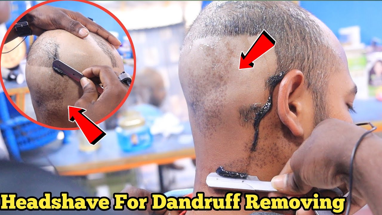 Straight Razor Headshave For Dandruff Removing Asmr Headshave Boy