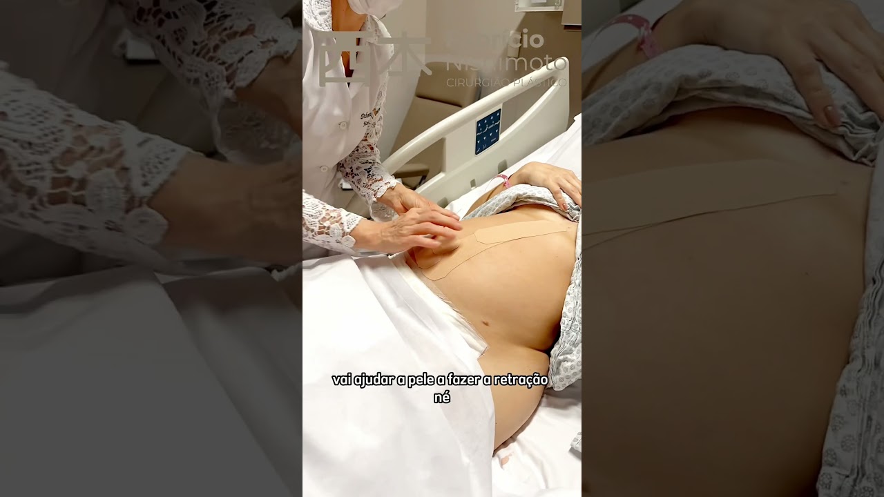 Taping pós operatório: Gestante. #clinicanishimoto