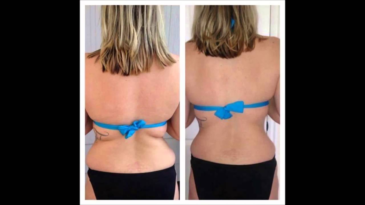 Nerium Firm video - Thomas