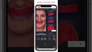 SmileFy's 3D Smile Design Demo (iPhone Demo) screenshot 5
