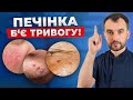 Перші ознаки проблем з печінкою НЕ ІГНОРУЙ ЦІ СИГНАЛИ