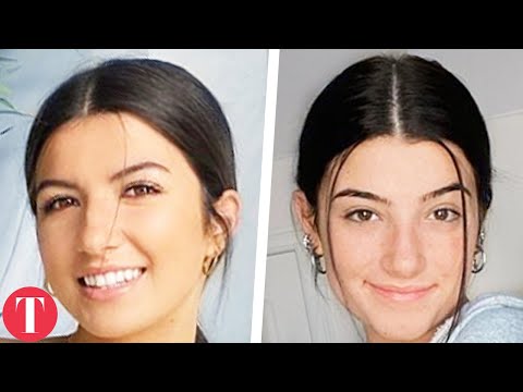 Video: Von "Lookalikes" Von Kardashians- Und Barbie-Puppen Bis Zu "Catwoman": Unglaubliche Geschichten Von Menschen, Die Sich Auf Der Suche Nach Schönheit Mit Plastik 