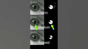 How Eye Tracking Pupil Fitters Work