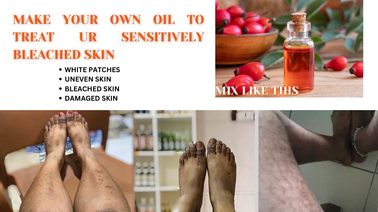 HOW TO MAKE REPAIR OIL TO TRANSFORM YOUR SKIN FROM SENSITIVE & BLEACHED