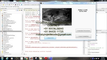 Matlab code for Abnormality detection in kidney ultrasound imaging