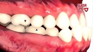 Campañas de prevención para la salud dental. Suiza Lab - Red Tv Web