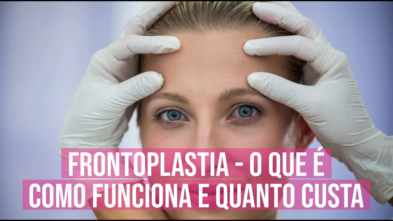 Frontoplastia o Que é, como Funciona e Quanto Custa - YouTube