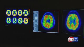 The Search for a Cure: Progress in Alzheimer's research