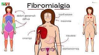 Fibromialgia: scopri come gestire il dolore e migliorare la qualità della vita