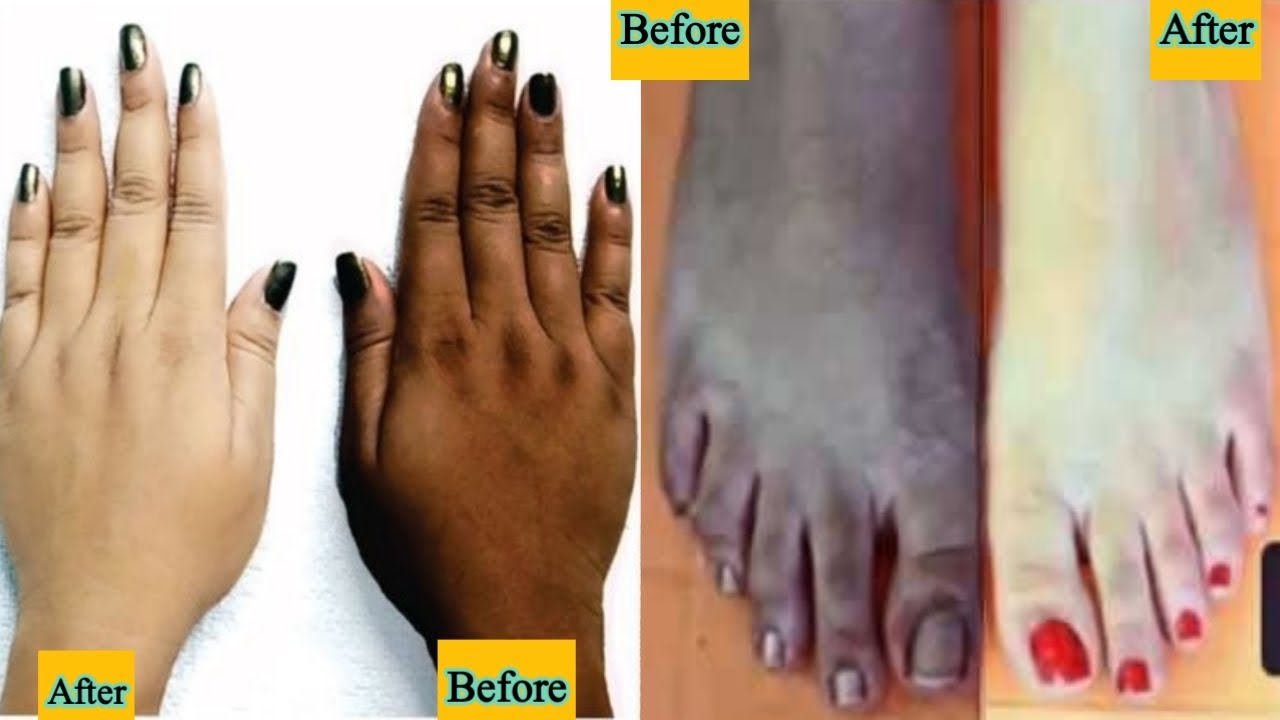Hand And Foot Whitening Tips Hand Whitening Home Remedy Hatho paon ko White Karne Ka