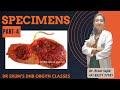 Specimens Part-4 | DNB Theory Class | DNB OBGYN coaching All India chapter| Live Class
