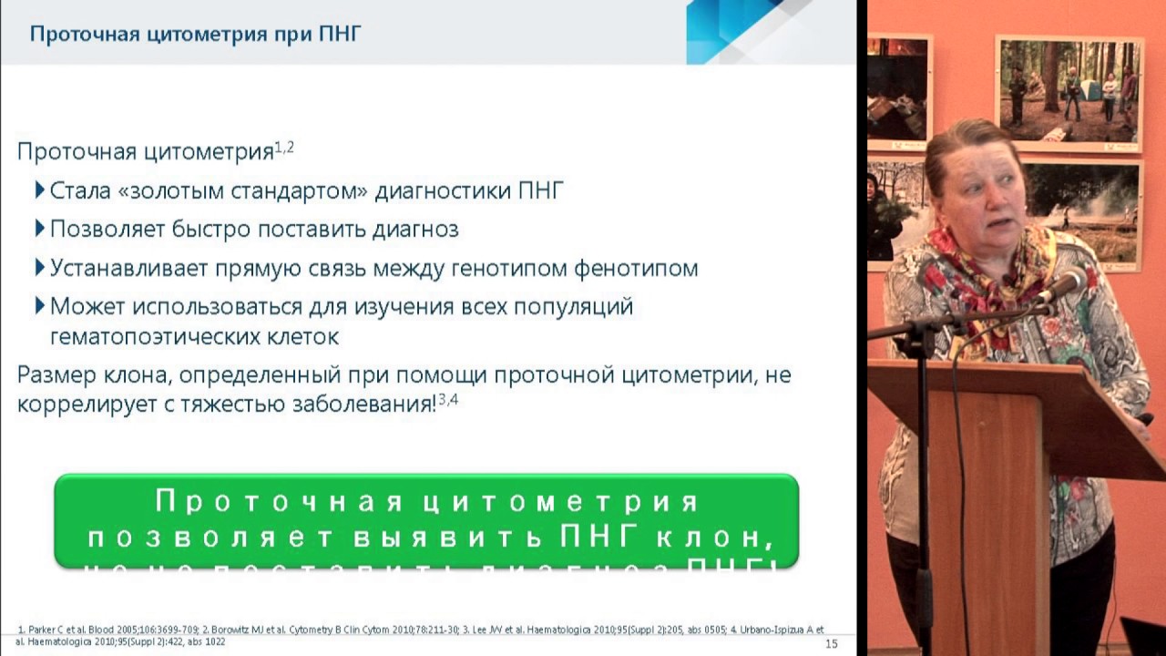 В.Л. ИВАНОВА, - Пароксизмальная ночная гемоглобинурия.