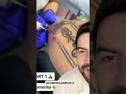 Video: ¿Está tatuado en el borde exterior?
