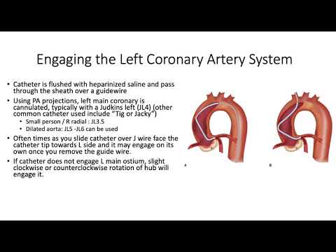 Left Heart Catheterization
