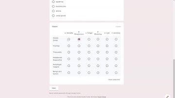 Using Google Forms as a tool for Assessment of Learning (Summative Assessment)