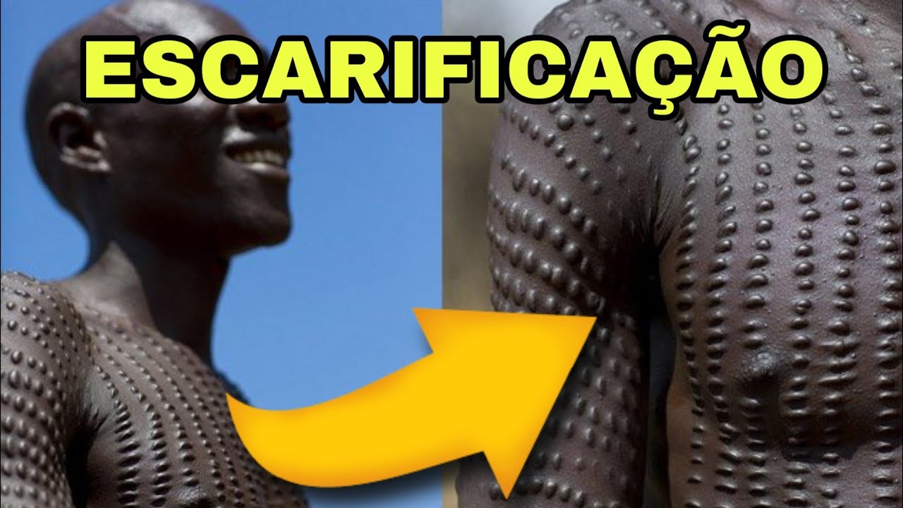 ESCARIFICAÇÃO NA ÁFRICA - YouTube