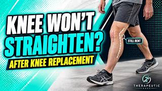 Can’t Straighten Your Knee After Knee Replacement? Start Here