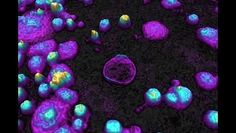 Cell culture reacting to drug treatment | HoloMonitor®