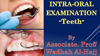 12- Intra-oral examination - 3 (Teeth). – Dr Wadhah Oral diagnosis lectures.  د/ وضاح الحاج screenshot 5