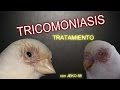 LA TRICOMONIASIS - Tratamiento