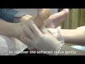 Callus Softener