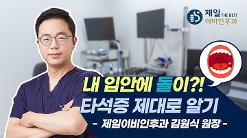 내 입안에 돌이?!  타석증 원인, 증상, 치료법