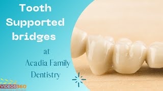 All about dental bridges at Acadia Family Dentistry