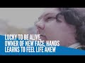 Lucky to be alive, owner of new face, hands learns to feel life anew