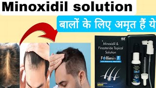 बाल झड़ते है तो एक बार जरूर use करें , minoxidil and Finasteride uses benefits, side effects