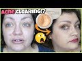 THIS WAS AN EMOTIONAL ROLLERCOASTER... | bareMinerals Blemish Rescue Loose Powder Foundation