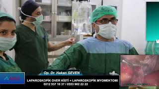 Laparoskopik Over Kisti ve Myomektomi / Op. Dr. Hakan SEVEN