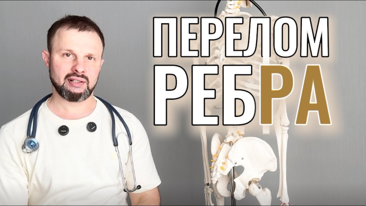 ДИАГНОСТИКА ПЕРЕЛОМА РЕБРА: ДЕЛАТЬ РЕНТГЕН ИЛИ КТ? разбираем с реабилитологом @posture_group