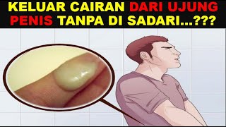 Penyebab Kelamin Keluar Cairan Putih Keluar Dari Ujung Tanpa Di Sadari