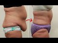 Secret military drink to lose 20 kg per month and burn belly fat in 7 days.