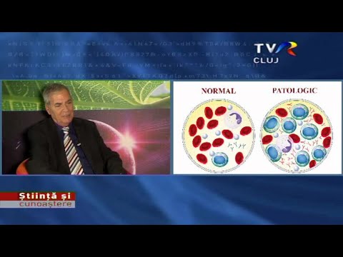 Video: Infecția Cu Herpesvirus 8 Uman Poate Contribui La Stresul Oxidativ La Pacienții Cu Diabet Zaharat De Tip 2