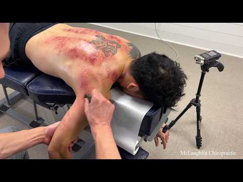 Difficult NECKS & Spines Get *CRACKED* Two Cases - TIGHT NECKS CAUSE PAIN & DECREASED ROM