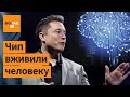 Слепые смогут видеть, парализованные – ходить. Чип Маска позволил управлять всем силой мысли!