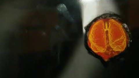 📷 Photography with Xiaomi MI A1