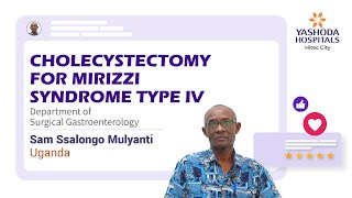 Cholecystectomy with Choledochoplasty for Mirizzi Syndrome Type IV | Yashoda Hospitals Hyderabad