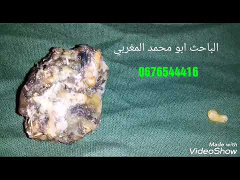 هل شرب الفاسوخ المغربي يفيد في علاج السحر الماكول والعين اسمع لتعرف