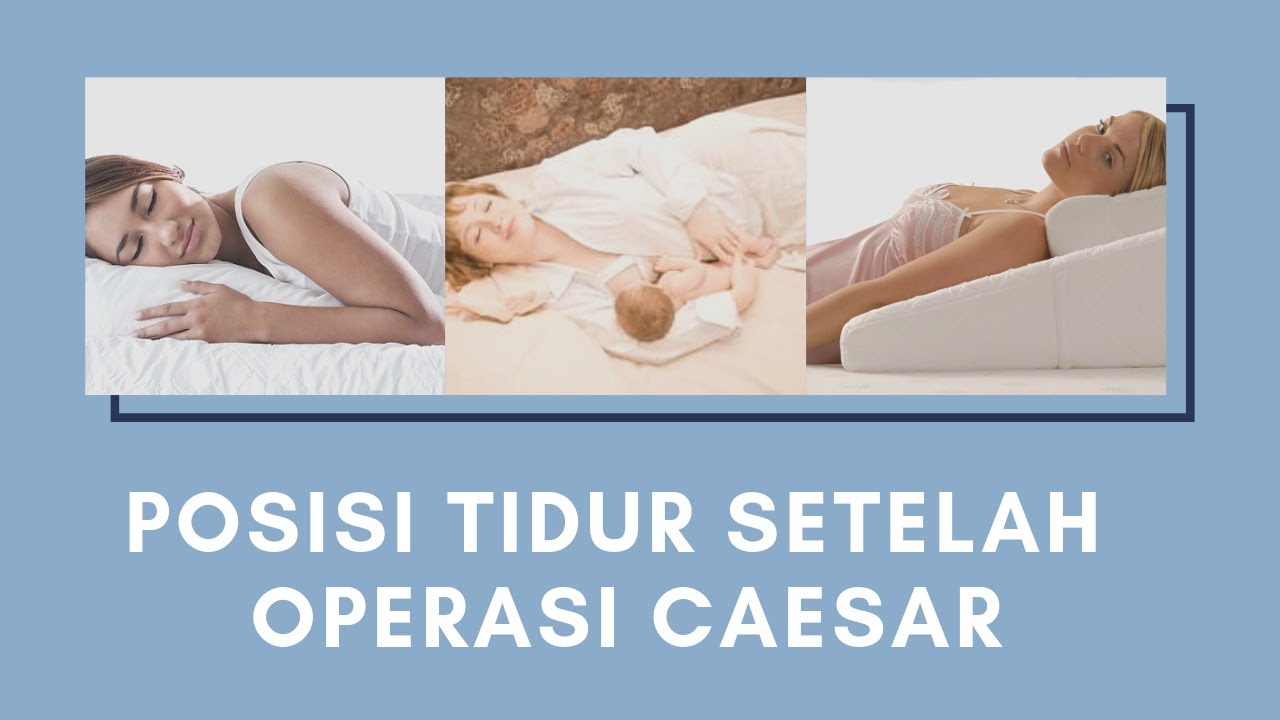 Posisi Tidur Setelah Operasi Caesar Herbania YouTube