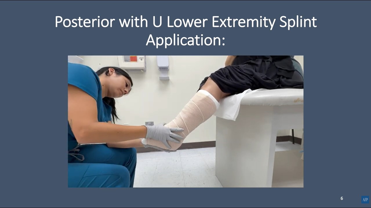 Lower Splint Posterior with U Lower Extremity Splint Application - YouTube