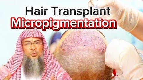 “Hair Transplant vs. Micropigmentation – What Is Permissible in Islam?”