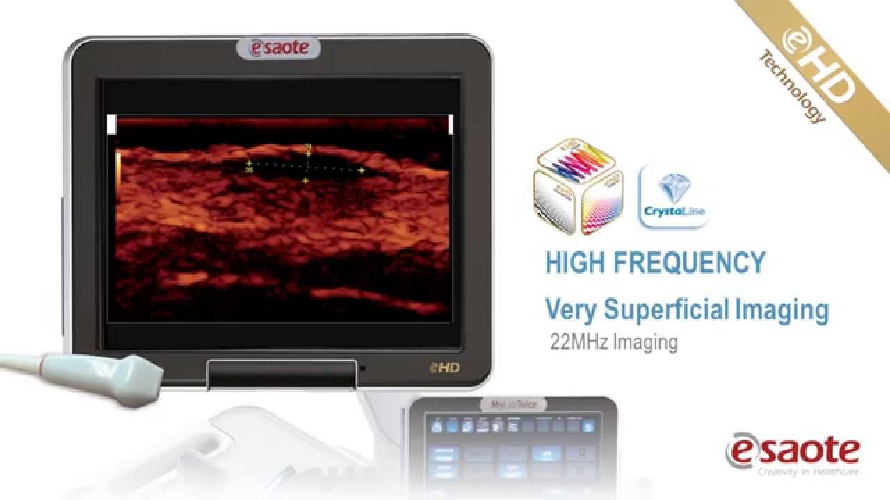 LINEAR IMAGING eHD Technology