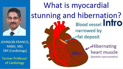 What is myocardial stunning and hibernation? Intro