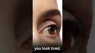 The Right Patient Precise Treatment Can Create Smoother Fresher Under Eye Without Looking Overdone