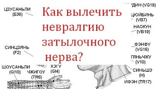 видео Невралгия ушного узла: причины, диагностика, лечение