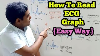 How to Read ECG Graph? ? | Understanding Various Defects {Easy Way}